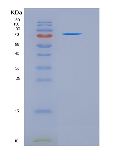 SDS-PAGE analysis of Human KIT (Mast/Stem Cell Growth Factor Receptor Kit) - Recombinant Protein, CATHuman KIT (Mast/Stem Cell Growth Factor Receptor Kit) - Recombinant Protein