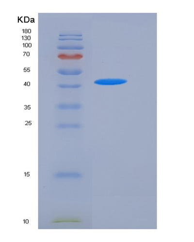 SDS-PAGE analysis of Human CD8B (T-Cell Surface Glycoprotein Cd8 Beta Chain) - Recombinant Protein, CAT# BLT-05579P, showing >85% purity under 15% SDS-PAGE (Reduced)Human CD8B (T-Cell Surface Glycoprotein Cd8 Beta Chain) - Recombinant Protein