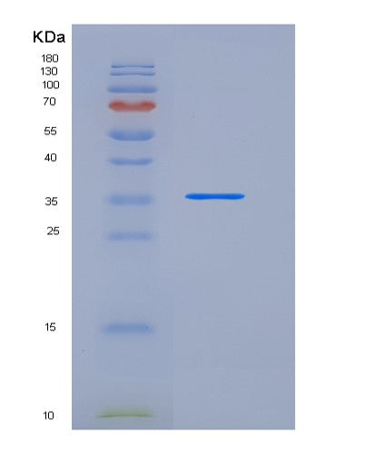 SDS-PAGE analysis of Human CARTPT (Cocaine- And Amphetamine-Regulated Transcript Protein) - Recombinant Protein, CATHuman CARTPT (Cocaine- And Amphetamine-Regulated Transcript Protein) - Recombinant Protein