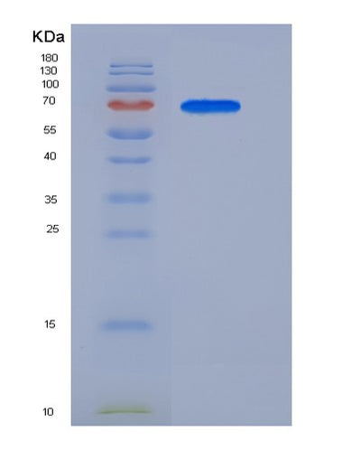 SDS-PAGE analysis of Human CROT (Peroxisomal Carnitine O-Octanoyltransferase) - Recombinant Protein, CAT# BLT-05589P, showing >85% purity under 15% SDS-PAGE (Reduced)Human CROT (Peroxisomal Carnitine O-Octanoyltransferase) - Recombinant Protein