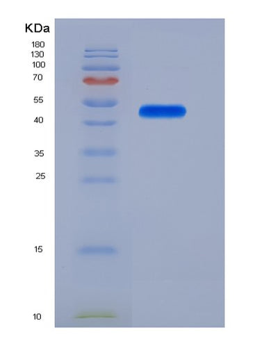 SDS-PAGE analysis of Human LRP10 (Low-Density Lipoprotein Receptor-Related Protein 10) - Recombinant Protein, CAT# BLT-05590P, showing >95% purity under 15% SDS-PAGE (Reduced)Human LRP10 (Low-Density Lipoprotein Receptor-Related Protein 10) - Recombinant Protein