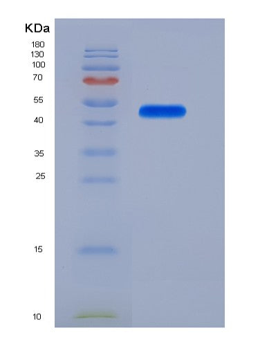 SDS-PAGE analysis of Human LRP10 (Low-Density Lipoprotein Receptor-Related Protein 10) - Recombinant Protein, CATHuman LRP10 (Low-Density Lipoprotein Receptor-Related Protein 10) - Recombinant Protein