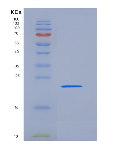 SDS-PAGE analysis of Human TIMP2 (Metalloproteinase Inhibitor 2) - Recombinant Protein, CATHuman TIMP2 (Metalloproteinase Inhibitor 2) - Recombinant Protein