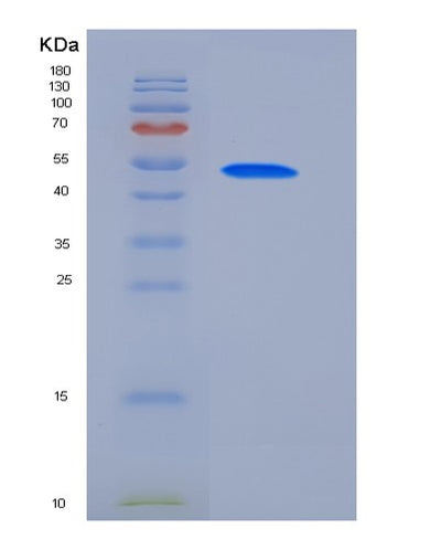 SDS-PAGE analysis of Human ALPI (Intestinal-Type Alkaline Phosphatase) - Recombinant Protein, CAT# BLT-05596P, showing >85% purity under 15% SDS-PAGE (Reduced)Human ALPI (Intestinal-Type Alkaline Phosphatase) - Recombinant Protein