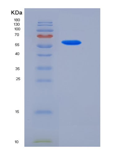 SDS-PAGE analysis of Human STC2 (Stanniocalcin-2) - Recombinant Protein, CAT# BLT-05597P, showing >95% purity under 15% SDS-PAGE (Reduced)Human STC2 (Stanniocalcin-2) - Recombinant Protein