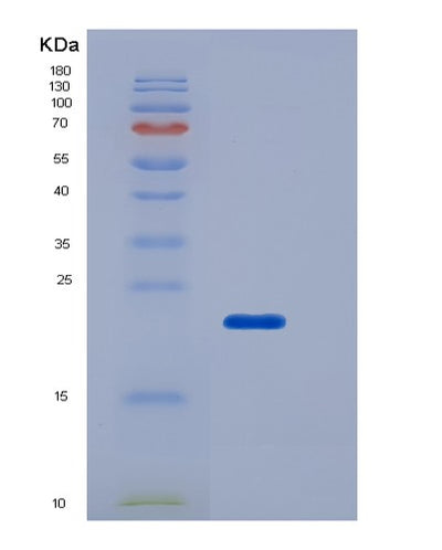 SDS-PAGE analysis of Human FCGR2B (Low Affinity Immunoglobulin Gamma Fc Region Receptor Ii-B) - Recombinant Protein, CAT# BLT-06271P, showing >85% purity under 15% SDS-PAGE (Reduced)Human FCGR2B (Low Affinity Immunoglobulin Gamma Fc Region Receptor Ii-B) - Recombinant Protein