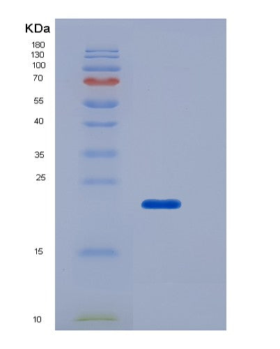 SDS-PAGE analysis of Human FCGR2B (Low Affinity Immunoglobulin Gamma Fc Region Receptor Ii-B) - Recombinant Protein, CATHuman FCGR2B (Low Affinity Immunoglobulin Gamma Fc Region Receptor Ii-B) - Recombinant Protein
