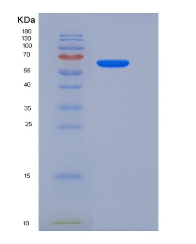 SDS-PAGE analysis of Human KMT5C (Histone-Lysine N-Methyltransferase Kmt5C) - Recombinant Protein, CAT# BLT-05602P, showing >85% purity under 15% SDS-PAGE (Reduced)Human KMT5C (Histone-Lysine N-Methyltransferase Kmt5C) - Recombinant Protein