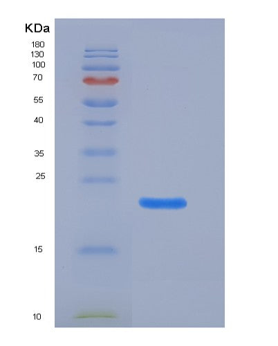 SDS-PAGE analysis of Mouse Klrb1a (Killer Cell Lectin-Like Receptor Subfamily B Member 1A) - Recombinant Protein, CATMouse Klrb1a (Killer Cell Lectin-Like Receptor Subfamily B Member 1A) - Recombinant Protein