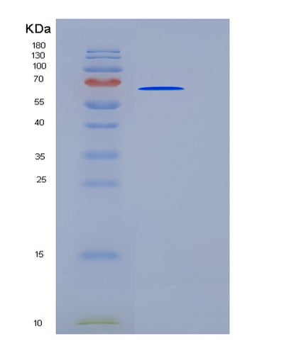 SDS-PAGE analysis of Human TLE3 (Transducin-Like Enhancer Protein 3) - Recombinant Protein, CAT# BLT-05613P, showing >95% purity under 15% SDS-PAGE (Reduced)Human TLE3 (Transducin-Like Enhancer Protein 3) - Recombinant Protein