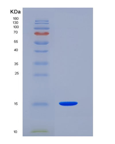 SDS-PAGE analysis of Human SLPI (Antileukoproteinase) - Recombinant Protein, CAT# BLT-05615P, showing >85% purity under 15% SDS-PAGE (Reduced)Human SLPI (Antileukoproteinase) - Recombinant Protein