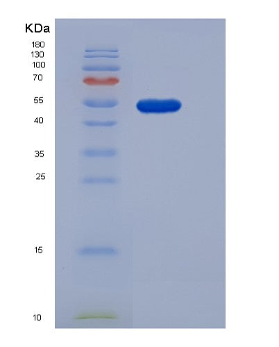 SDS-PAGE analysis of Human PNLIP (Pancreatic Triacylglycerol Lipase) - Recombinant Protein, CATHuman PNLIP (Pancreatic Triacylglycerol Lipase) - Recombinant Protein
