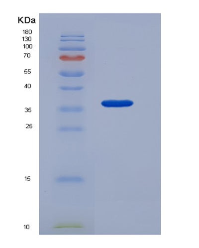 SDS-PAGE analysis of Human CD3D (T-Cell Surface Glycoprotein Cd3 Delta Chain) - Recombinant Protein, CAT# BLT-05620P, showing >95% purity under 15% SDS-PAGE (Reduced)Human CD3D (T-Cell Surface Glycoprotein Cd3 Delta Chain) - Recombinant Protein