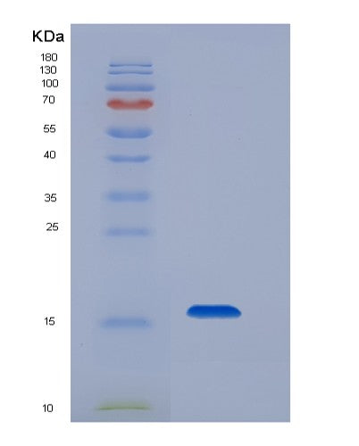 SDS-PAGE analysis of Mouse Cd79b (B-Cell Antigen Receptor Complex-Associated Protein Beta Chain) - Recombinant Protein, CATMouse Cd79b (B-Cell Antigen Receptor Complex-Associated Protein Beta Chain) - Recombinant Protein