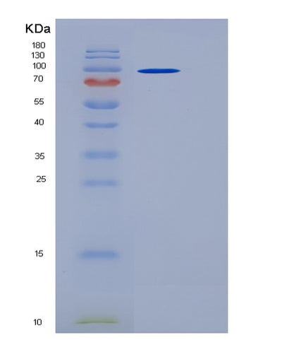 SDS-PAGE analysis of Human IL6ST (Interleukin-6 Receptor Subunit Beta) - Recombinant Protein, CAT# BLT-05631P, showing >95% purity under 15% SDS-PAGE (Reduced)Human IL6ST (Interleukin-6 Receptor Subunit Beta) - Recombinant Protein