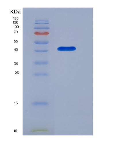 SDS-PAGE analysis of Mouse Cd28 (T-Cell-Specific Surface Glycoprotein Cd28) - Recombinant Protein, CAT# BLT-05633P, showing >85% purity under 15% SDS-PAGE (Reduced)Mouse Cd28 (T-Cell-Specific Surface Glycoprotein Cd28) - Recombinant Protein