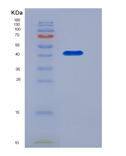 SDS-PAGE analysis of Mouse Cd28 (T-Cell-Specific Surface Glycoprotein Cd28) - Recombinant Protein, CATMouse Cd28 (T-Cell-Specific Surface Glycoprotein Cd28) - Recombinant Protein