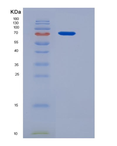 SDS-PAGE analysis of Mouse Ltf (Lactotransferrin) - Recombinant Protein, CAT# BLT-05635P, showing >85% purity under 15% SDS-PAGE (Reduced)Mouse Ltf (Lactotransferrin) - Recombinant Protein