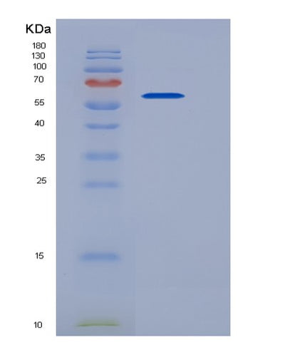 SDS-PAGE analysis of Human ALDH4A1 (Delta-1-Pyrroline-5-Carboxylate Dehydrogenase, Mitochondrial) - Recombinant Protein, CAT# BLT-05636P, showing >90% purity under 15% SDS-PAGE (Reduced)Human ALDH4A1 (Delta-1-Pyrroline-5-Carboxylate Dehydrogenase, Mitochondrial) - Recombinant Protein