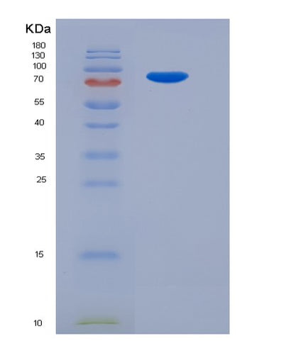 SDS-PAGE analysis of Human PDE3A (Cgmp-Inhibited 3',5'-Cyclic Phosphodiesterase 3A) - Recombinant Protein, CAT# BLT-05638P, showing >85% purity under 15% SDS-PAGE (Reduced)Human PDE3A (Cgmp-Inhibited 3',5'-Cyclic Phosphodiesterase 3A) - Recombinant Protein