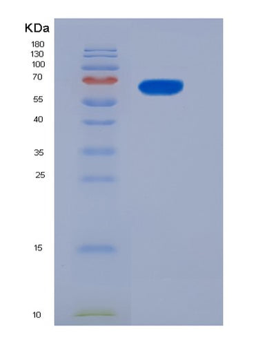 SDS-PAGE analysis of Mouse Il13ra1 (Interleukin-13 Receptor Subunit Alpha-1) - Recombinant Protein, CAT# BLT-05645P, showing >90% purity under 15% SDS-PAGE (Reduced)Mouse Il13ra1 (Interleukin-13 Receptor Subunit Alpha-1) - Recombinant Protein