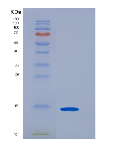 SDS-PAGE analysis of Human CDK2AP2 (Cyclin-Dependent Kinase 2-Associated Protein 2) - Recombinant Protein, CATHuman CDK2AP2 (Cyclin-Dependent Kinase 2-Associated Protein 2) - Recombinant Protein