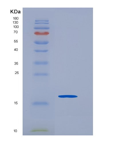 SDS-PAGE analysis of Human SCN3B (Sodium Channel Regulatory Subunit Beta-3) - Recombinant Protein, CATHuman SCN3B (Sodium Channel Regulatory Subunit Beta-3) - Recombinant Protein