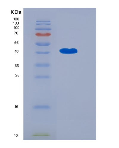 SDS-PAGE analysis of Human OMG (Oligodendrocyte-Myelin Glycoprotein) - Recombinant Protein, CAT# BLT-05652P, showing >95% purity under 15% SDS-PAGE (Reduced)Human OMG (Oligodendrocyte-Myelin Glycoprotein) - Recombinant Protein
