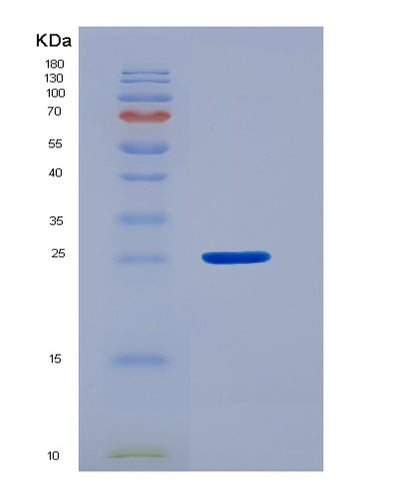SDS-PAGE analysis of Human C1QBP (Complement Component 1 Q Subcomponent-Binding Protein, Mitochondrial) - Recombinant Protein, CAT# BLT-05661P, showing >90% purity under 15% SDS-PAGE (Reduced)Human C1QBP (Complement Component 1 Q Subcomponent-Binding Protein, Mitochondrial) - Recombinant Protein