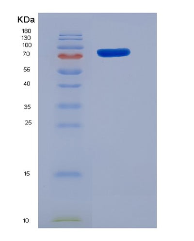 SDS-PAGE analysis of Mouse Smad5 (Mothers Against Decapentaplegic Homolog 5) - Recombinant Protein, CAT# BLT-05662P, showing >90% purity under 15% SDS-PAGE (Reduced)Mouse Smad5 (Mothers Against Decapentaplegic Homolog 5) - Recombinant Protein