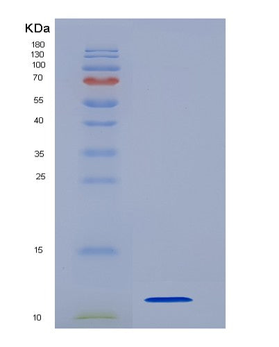SDS-PAGE analysis of Human S100A6 (Protein S100-A6) - Recombinant Protein, CATHuman S100A6 (Protein S100-A6) - Recombinant Protein