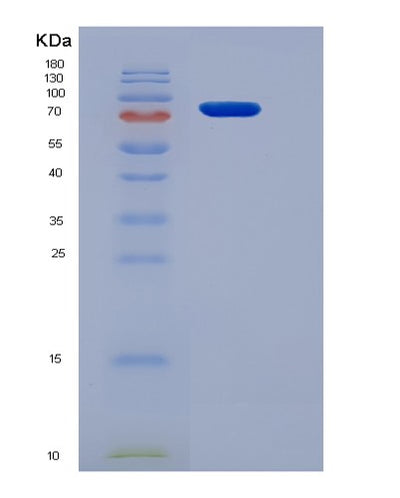 SDS-PAGE analysis of Mouse Smad2 (Mothers Against Decapentaplegic Homolog 2) - Recombinant Protein, CAT# BLT-05665P, showing >85% purity under 15% SDS-PAGE (Reduced)Mouse Smad2 (Mothers Against Decapentaplegic Homolog 2) - Recombinant Protein