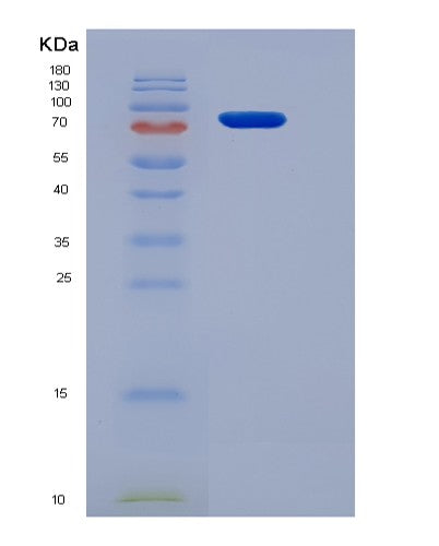 SDS-PAGE analysis of Mouse Smad2 (Mothers Against Decapentaplegic Homolog 2) - Recombinant Protein, CATMouse Smad2 (Mothers Against Decapentaplegic Homolog 2) - Recombinant Protein