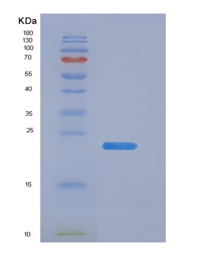 SDS-PAGE analysis of Human TIMP1 (Metalloproteinase Inhibitor 1) - Recombinant Protein, CAT# BLT-05669P, showing >95% purity under 15% SDS-PAGE (Reduced)Human TIMP1 (Metalloproteinase Inhibitor 1) - Recombinant Protein