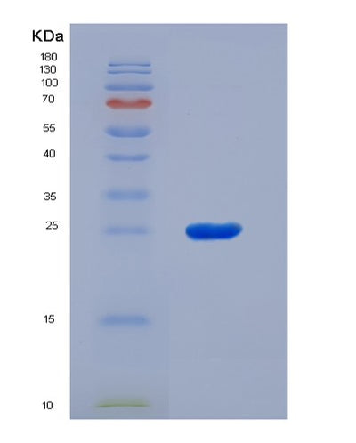 SDS-PAGE analysis of Human BTN3A3 (Butyrophilin Subfamily 3 Member A3) - Recombinant Protein, CAT# BLT-05673P, showing >95% purity under 15% SDS-PAGE (Reduced)Human BTN3A3 (Butyrophilin Subfamily 3 Member A3) - Recombinant Protein