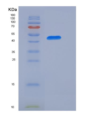 SDS-PAGE analysis of Human BTN3A3 (Butyrophilin Subfamily 3 Member A3) - Recombinant Protein, CAT# BLT-05676P, showing >90% purity under 15% SDS-PAGE (Reduced)Human BTN3A3 (Butyrophilin Subfamily 3 Member A3) - Recombinant Protein