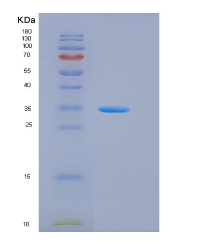 SDS-PAGE analysis of Human CSAG1 (Chondrosarcoma-Associated Gene 1 Protein) - Recombinant Protein, CAT# BLT-05679P, showing >85% purity under 15% SDS-PAGE (Reduced)Human CSAG1 (Chondrosarcoma-Associated Gene 1 Protein) - Recombinant Protein