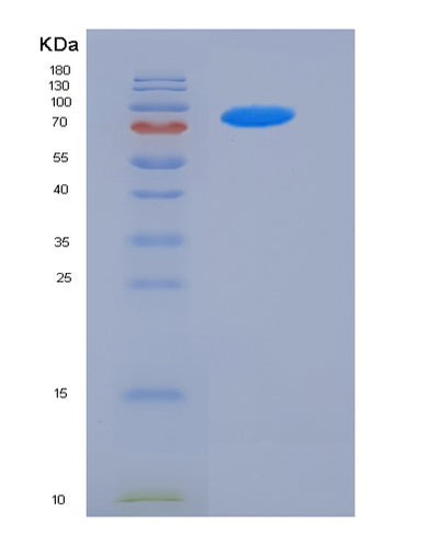 SDS-PAGE analysis of Human FSTL5 (Follistatin-Related Protein 5) - Recombinant Protein, CAT# BLT-05681P, showing >90% purity under 15% SDS-PAGE (Reduced)Human FSTL5 (Follistatin-Related Protein 5) - Recombinant Protein
