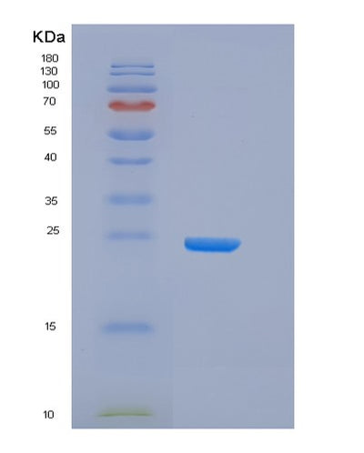 SDS-PAGE analysis of Human FCGR2B (Low Affinity Immunoglobulin Gamma Fc Region Receptor Ii-B) - Recombinant Protein, CAT# BLT-05686P, showing >90% purity under 15% SDS-PAGE (Reduced)Human FCGR2B (Low Affinity Immunoglobulin Gamma Fc Region Receptor Ii-B) - Recombinant Protein