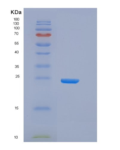 SDS-PAGE analysis of Human FCGR2B (Low Affinity Immunoglobulin Gamma Fc Region Receptor Ii-B) - Recombinant Protein, CATHuman FCGR2B (Low Affinity Immunoglobulin Gamma Fc Region Receptor Ii-B) - Recombinant Protein