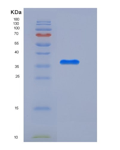 SDS-PAGE analysis of Human APEX1 (Dna Repair Nuclease/Redox Regulator Apex1) - Recombinant Protein, CATHuman APEX1 (Dna Repair Nuclease/Redox Regulator Apex1) - Recombinant Protein