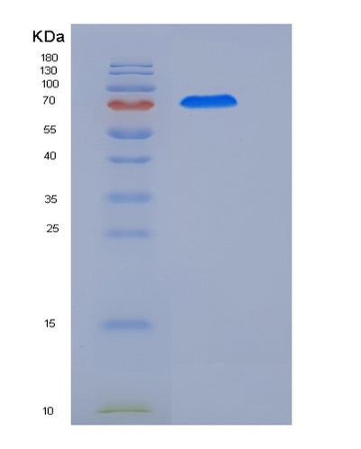SDS-PAGE analysis of Human CCNE1 (G1/S-Specific Cyclin-E1) - Recombinant Protein, CAT# BLT-05695P, showing >90% purity under 15% SDS-PAGE (Reduced)Human CCNE1 (G1/S-Specific Cyclin-E1) - Recombinant Protein