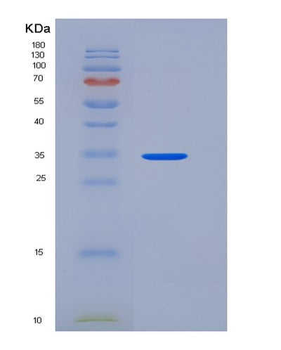 SDS-PAGE analysis of Human CXCL8 (Interleukin-8) - Recombinant Protein, CAT# BLT-05697P, showing >85% purity under 15% SDS-PAGE (Reduced)Human CXCL8 (Interleukin-8) - Recombinant Protein