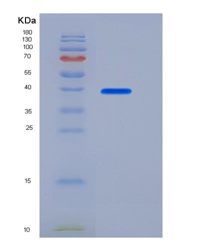 SDS-PAGE analysis of Human BMP2 (Bone Morphogenetic Protein 2) - Recombinant Protein, CATHuman BMP2 (Bone Morphogenetic Protein 2) - Recombinant Protein