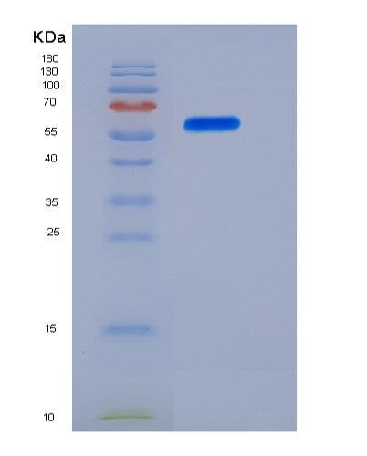SDS-PAGE analysis of Human IL-12 (IL12A &IL12B Heterodimer) - Recombinant Protein, CATHuman IL-12 (IL12A &IL12B Heterodimer) - Recombinant Protein