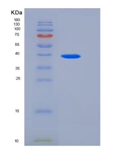 SDS-PAGE analysis of Human BST2 (Bone Marrow Stromal Antigen 2) - Recombinant Protein, CAT# BLT-05709P, showing >90% purity under 15% SDS-PAGE (Reduced)Human BST2 (Bone Marrow Stromal Antigen 2) - Recombinant Protein