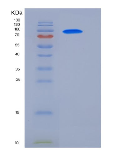 SDS-PAGE analysis of Human GAD2 (Glutamate Decarboxylase 2) - Recombinant Protein, CAT# BLT-05710P, showing >85% purity under 15% SDS-PAGE (Reduced)Human GAD2 (Glutamate Decarboxylase 2) - Recombinant Protein