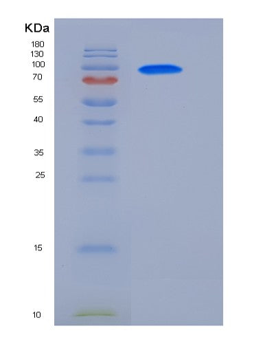 SDS-PAGE analysis of Human GAD2 (Glutamate Decarboxylase 2) - Recombinant Protein, CATHuman GAD2 (Glutamate Decarboxylase 2) - Recombinant Protein