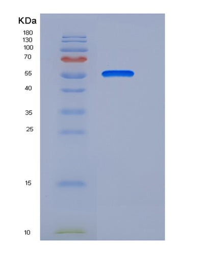 SDS-PAGE analysis of Human ANTXR1 (Anthrax Toxin Receptor 1) - Recombinant Protein, CAT# BLT-05712P, showing >90% purity under 15% SDS-PAGE (Reduced)Human ANTXR1 (Anthrax Toxin Receptor 1) - Recombinant Protein
