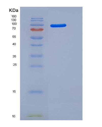 SDS-PAGE analysis of Mouse Ago2 (Protein Argonaute-2) - Recombinant Protein, CAT# BLT-05714P, showing >90% purity under 15% SDS-PAGE (Reduced)Mouse Ago2 (Protein Argonaute-2) - Recombinant Protein